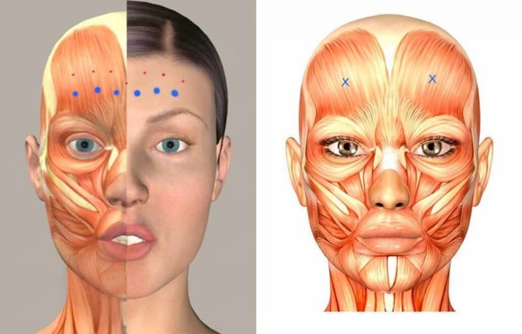 voorhoofdsrimpels-anatomie-jc-kliniek